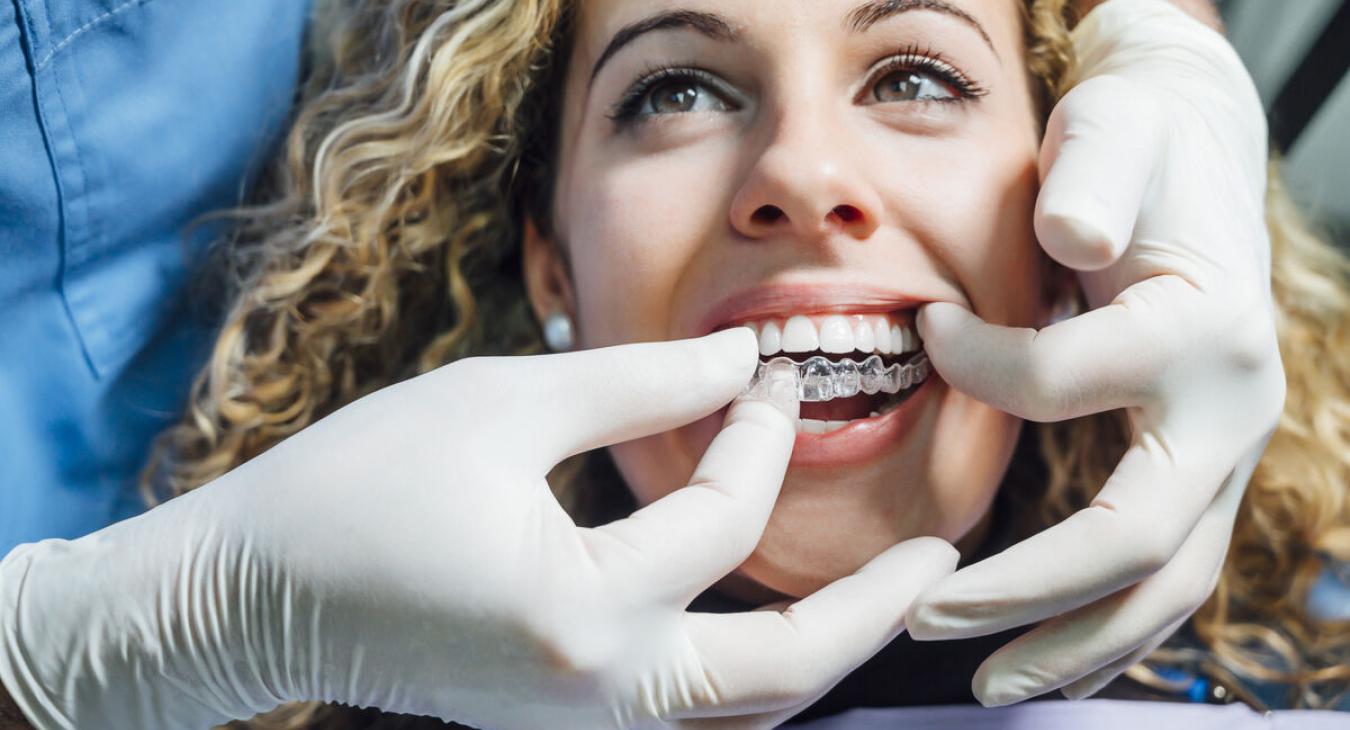 Les gouttières transparentes Invisalign : la solution orthodontique invisible pour un sourire parfait